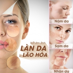NGUYÊN NHÂN HÌNH THÀNH SẠM DA, NÁM DA, KHÔ DA, NHĂN DA
