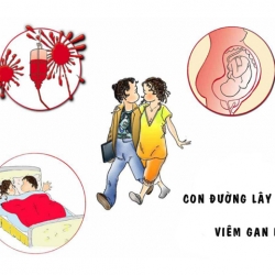 Viêm Gan B Lây Qua Đường Nào?