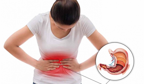 Nguyên Nhân Bị Đau Dạ Dày