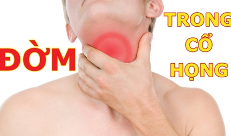 Nguyên Nhân Gây Đờm Trong Cổ Họng