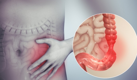 Viêm Đại Tràng Có Nguy Hiểm Không?