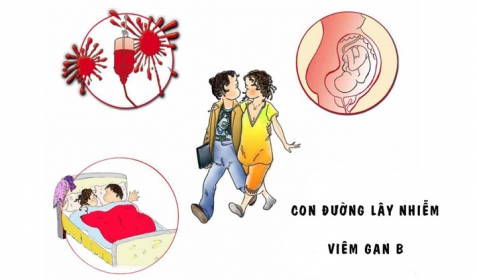 Viêm Gan B Lây Qua Đường Nào?