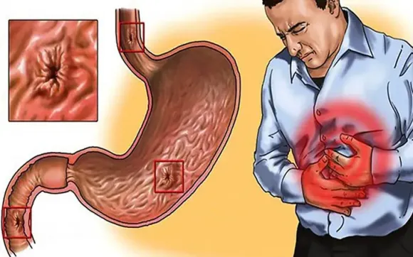 Triệu Chứng Mất Ngủ Kéo Dài: nguyên nhân, hệ quả, cách khắc phục