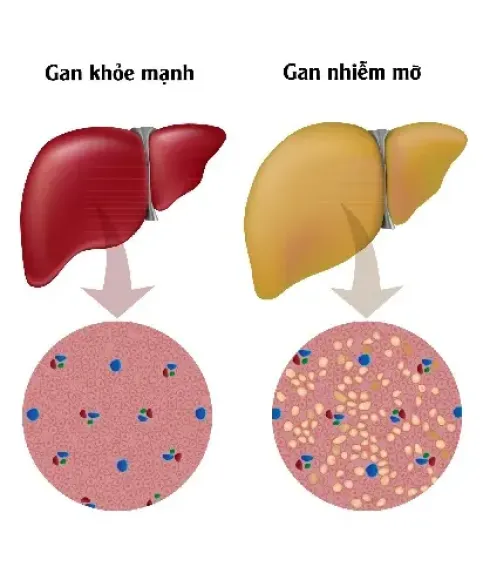 Triệu Chứng Mất Ngủ Kéo Dài: nguyên nhân, hệ quả, cách khắc phục