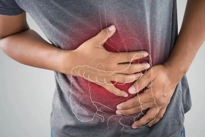 Rối loạn tiêu hóa