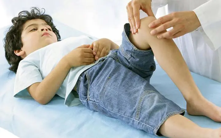 Bệnh viêm khớp tự phát thiếu niên