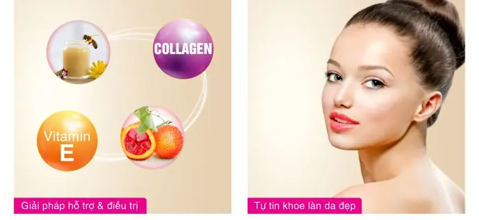 vi&ecirc;n uống đẹp da lycopen