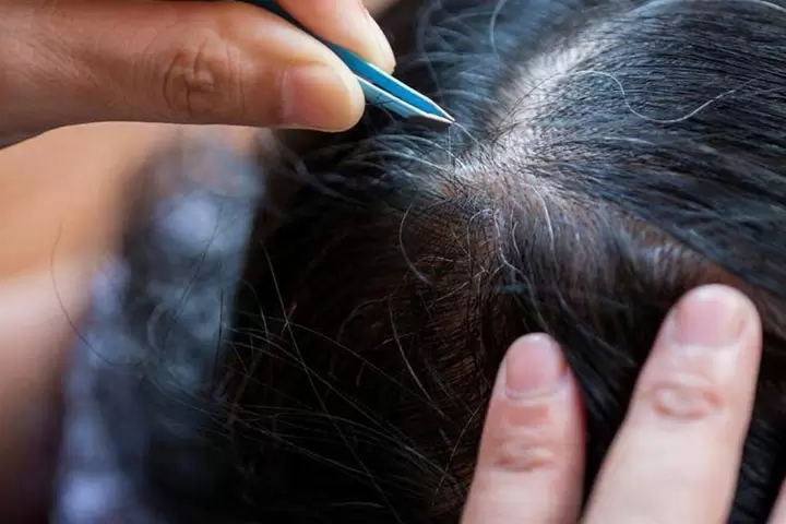 Nguy&ecirc;n nh&acirc;n g&acirc;y ra t&oacute;c bạc